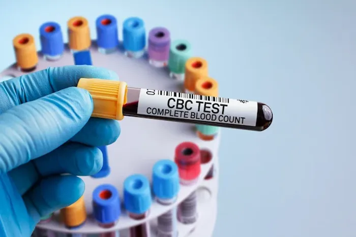 cbc test