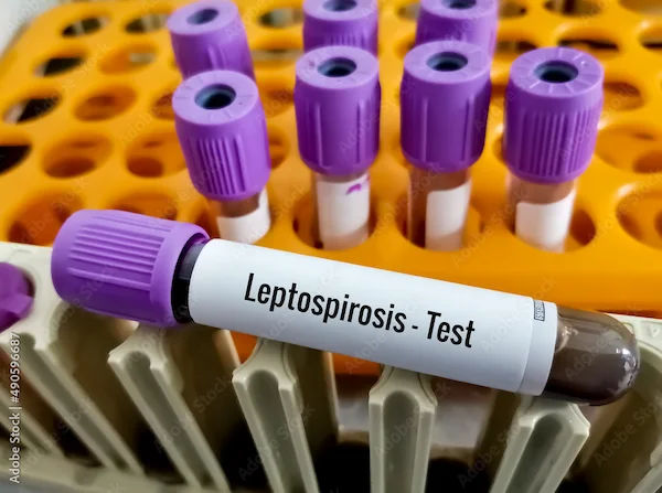 Causes and Treatment of Leptospirosis