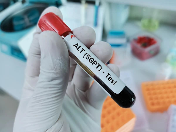 sgpt test