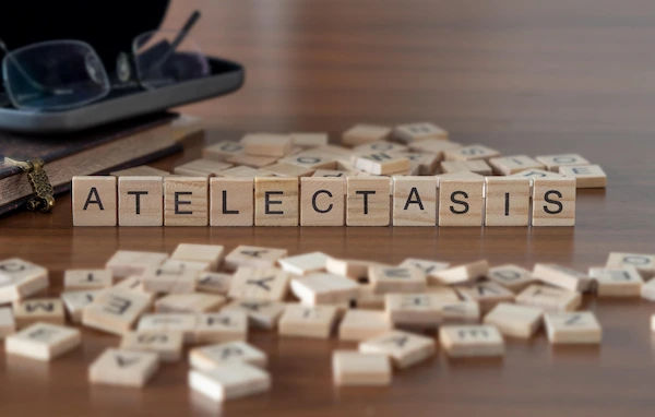 atelectasis