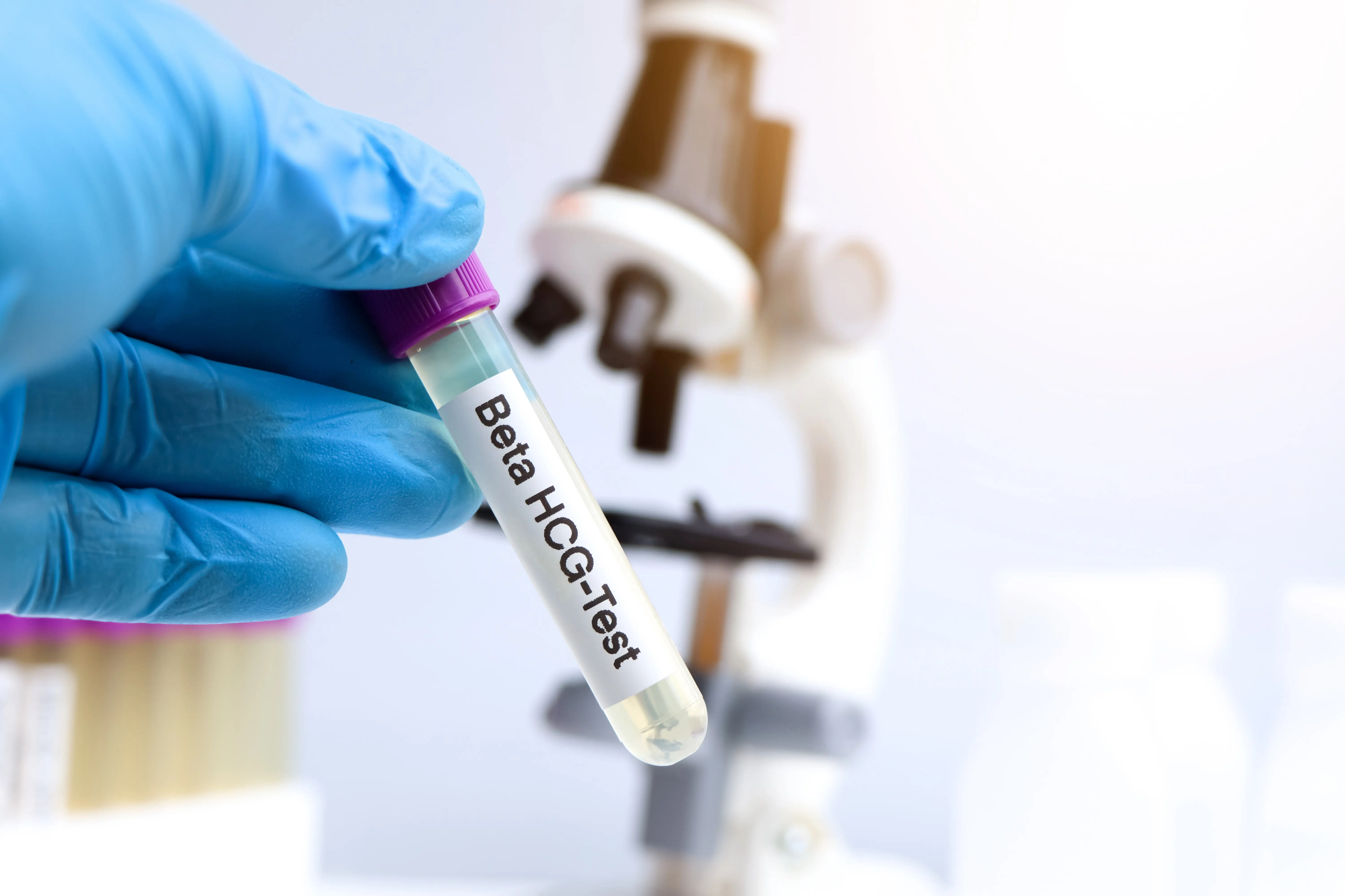 Beta hCG