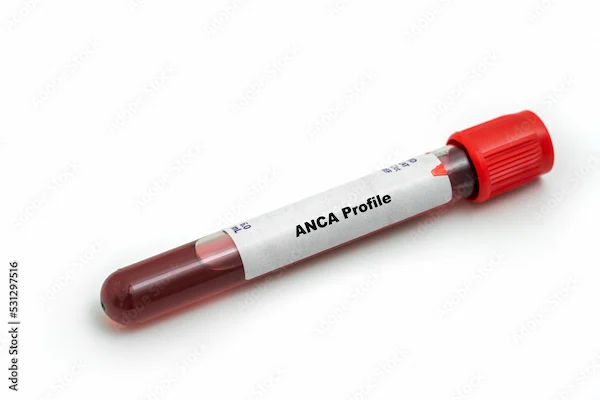 Understanding the ANCA Test