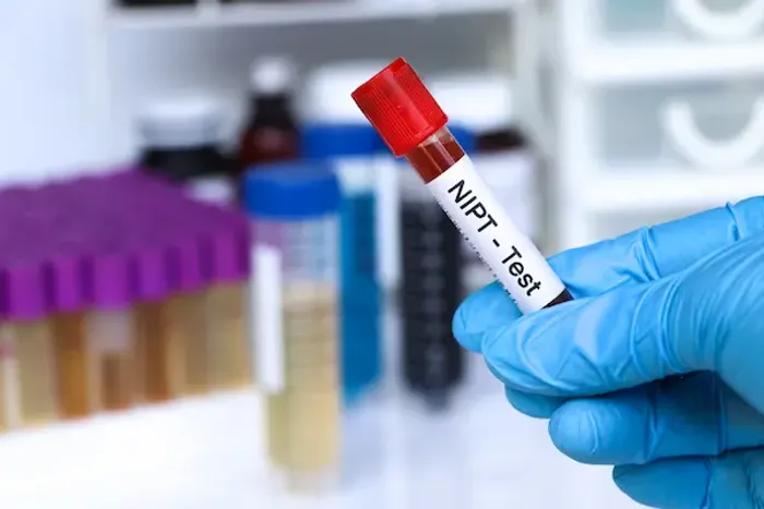 NIPT Test
