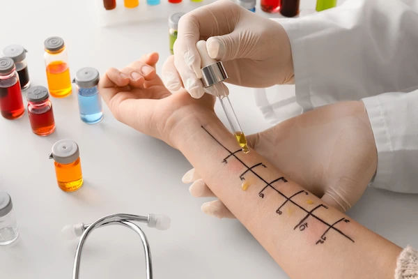 Skin Allergy