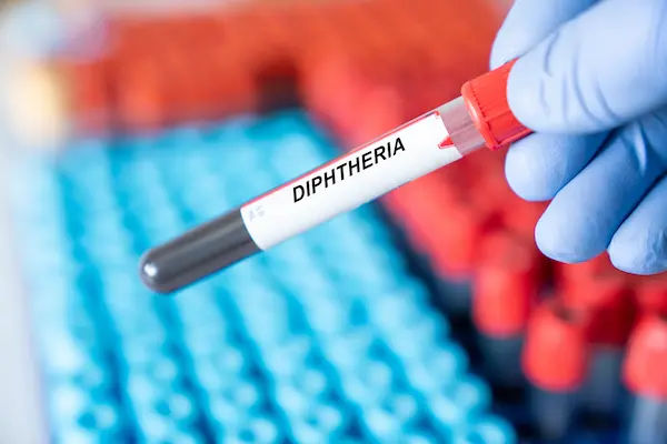 Diphtheria