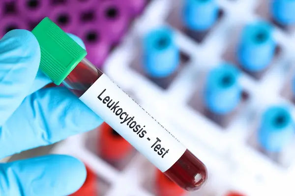 Leukocytosis