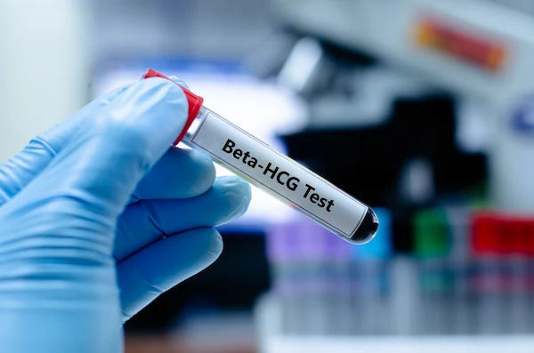 Beta HCG Test Overview and Interpretation