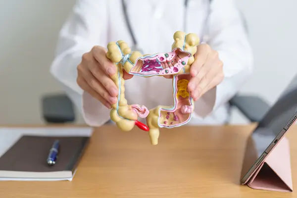 Diverticulitis