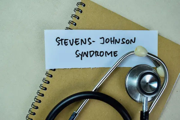 Stevens-Johnson Syndrome