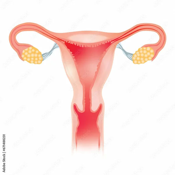 Understanding Bicornuate Uterus and Its Diagnosis