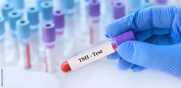 TSH Test Overview and Procedure