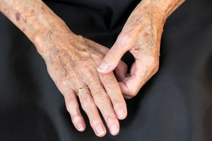 Causes and Treatment of Ring Avulsion