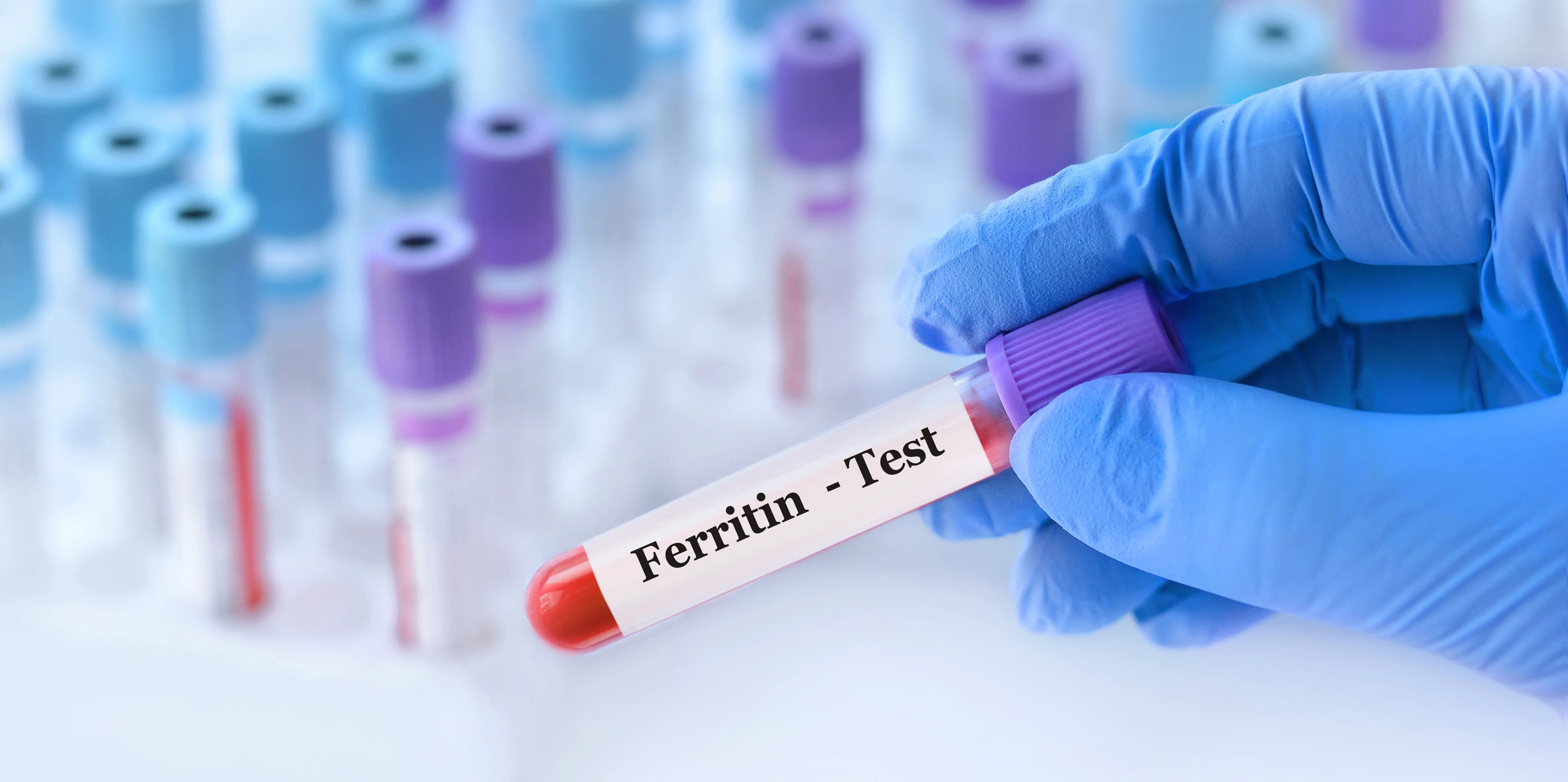 Ferritin