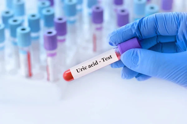Uric Acid Levels and Related Information