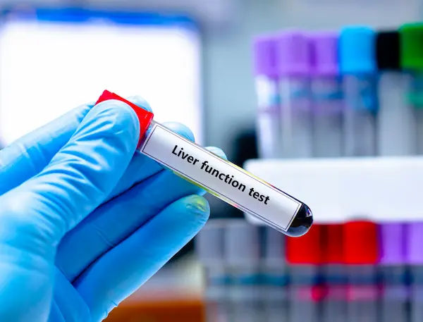 Liver Function Test:
