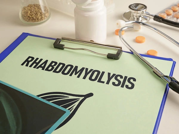 Rhabdomyolysis