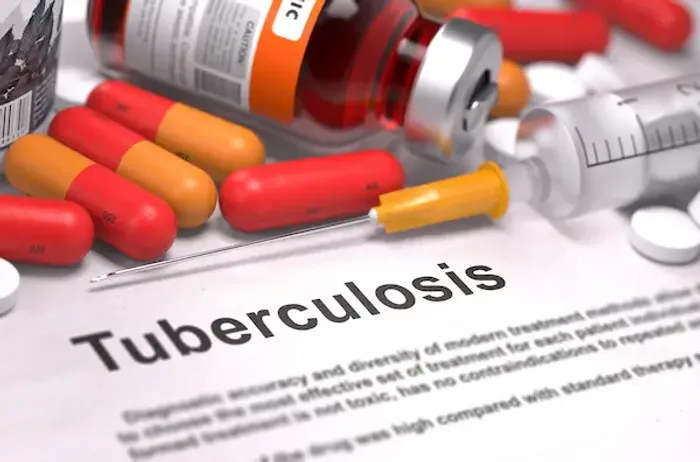 Tuberculosis