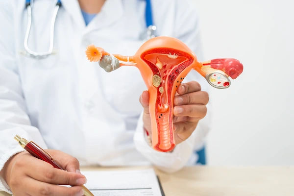 Causes of Cervical Cancer Explained