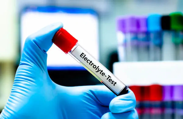 Electrolyte Testing