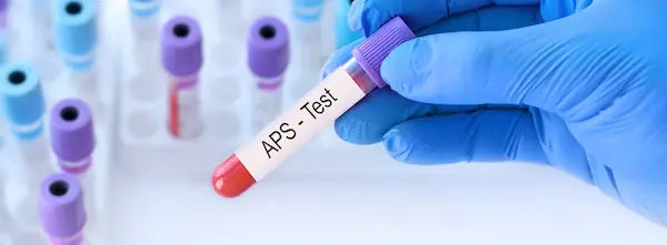 Anti-Phospholipid Syndrome
