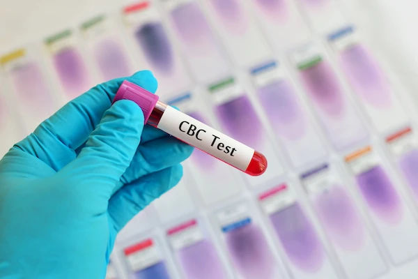 cbc test