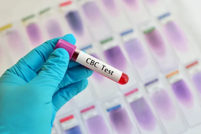 cbc test