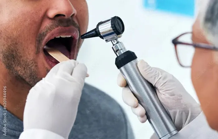 Mouth Cancer Overview Causes, Symptoms, and Treatment