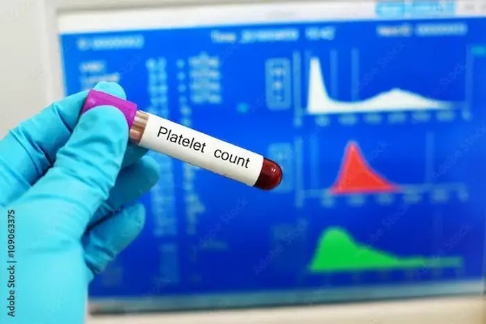 Platelet Count In Dengue Fever