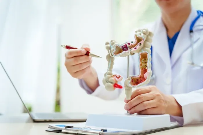 bowel cancer
