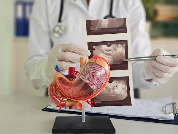 endoscopic ultrasound