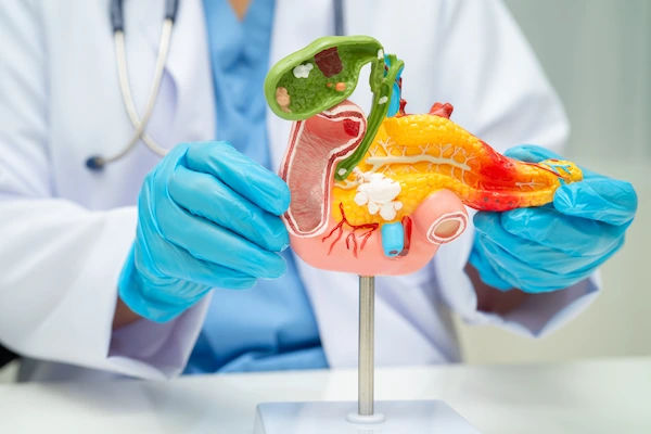 bile duct cancer