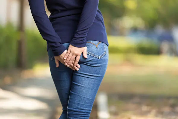 Prolapsed Hemorrhoids