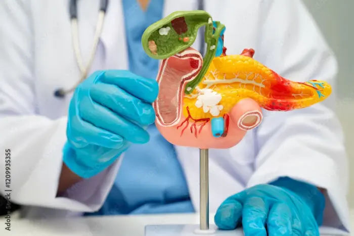 Your Guide to Robotic Gallbladder Surgery: Benefits, Risks & Recovery