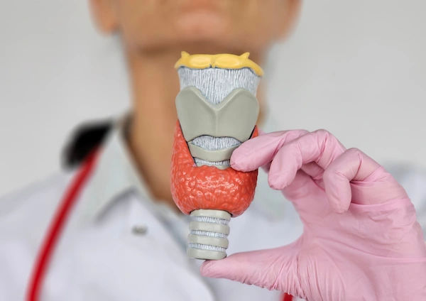 hypothyroidism