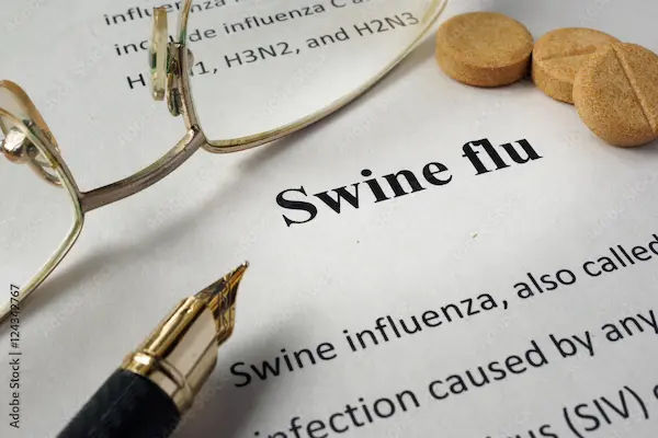 Swine Flu