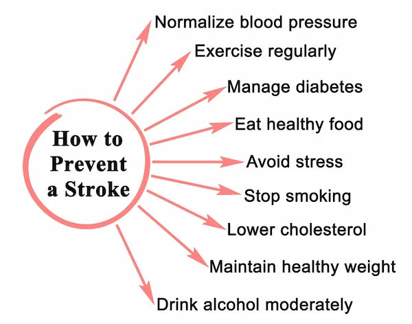 Guide to Preventing Stroke