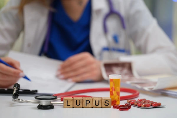 Lupus Signs, Diagnosis, and Treatment: A Complete Guide