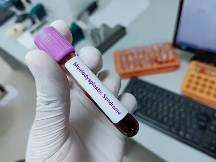 Myelodysplastic Syndrome Mds