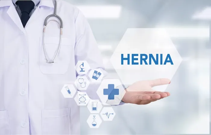 Umbilical Hernia Overview and Information