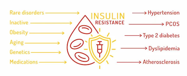 ​PCOS and Diabetes: The Critical Link and How to Stay Healthy