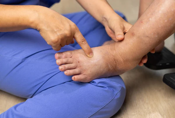 Guide to Link Between Diabetes And Liver Disease