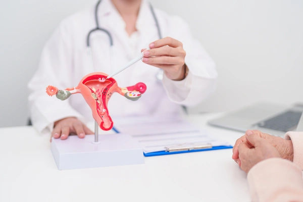 Pcos