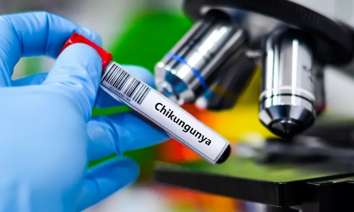 What Leads To Chikungunya Virus And Prevention?