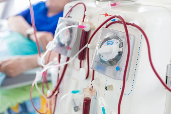 A Complete Guide to Dialysis: Types, Risks, and Complications