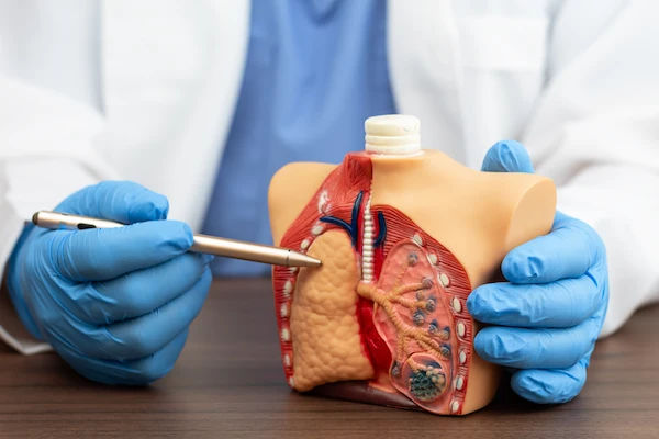 Lung Fibrosis
