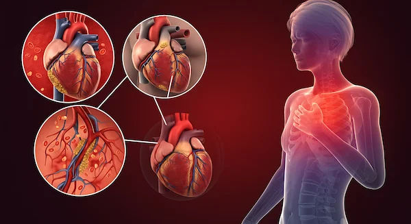 Heart Block: Causes, Types, and What to Do Next