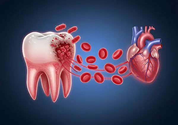 Connection Between Oral Health Heart Disease
