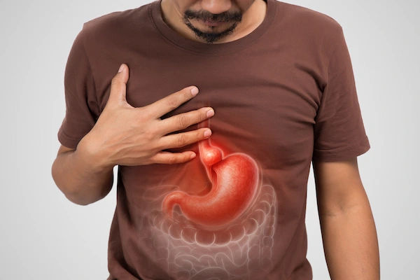 hiatal hernia