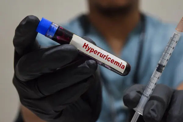 Hyperuricemia