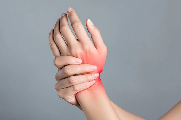 arthritis